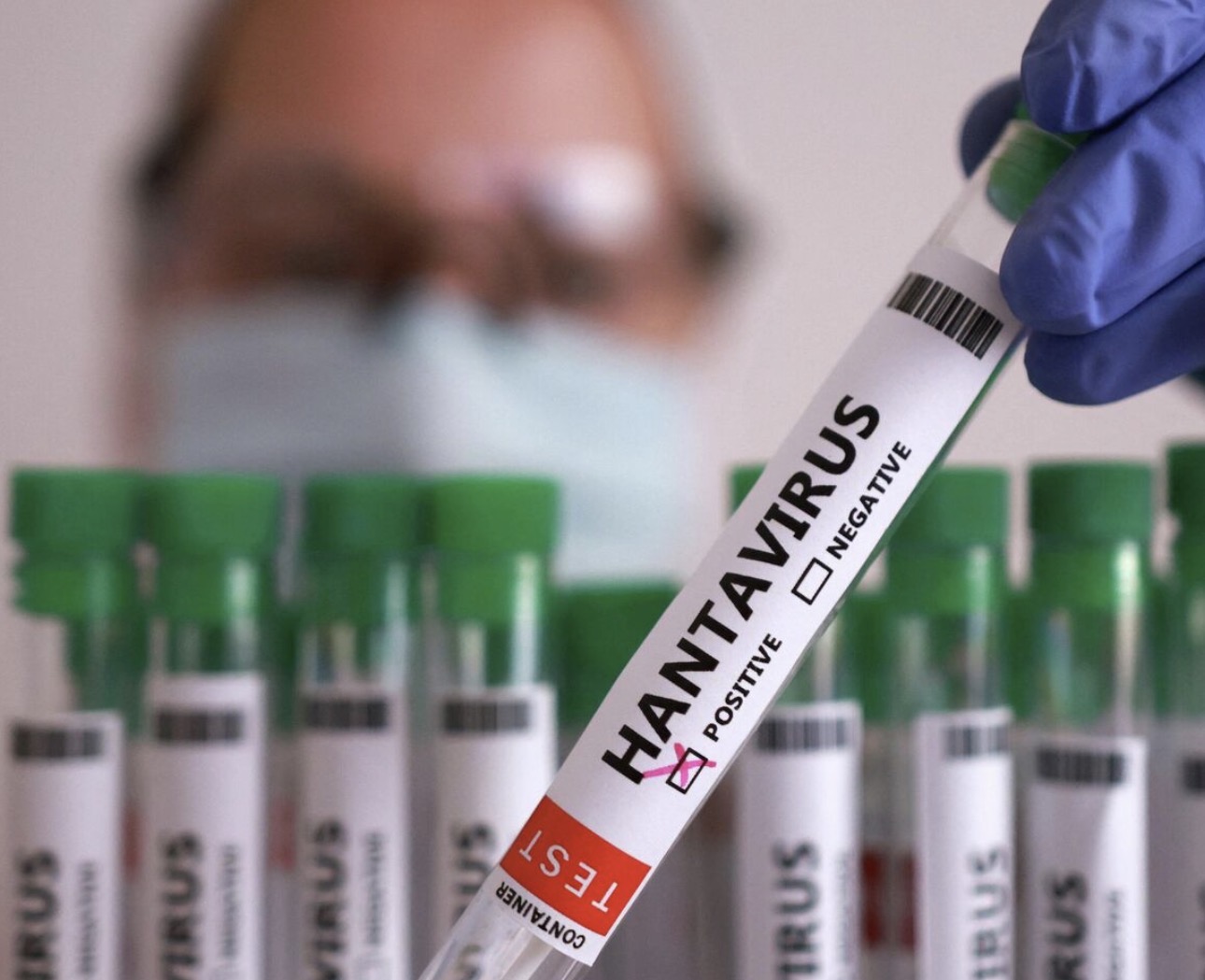 Hantavirus on a Cruise Ship: Everything You Need to Know About the MV Hondius Outbreak